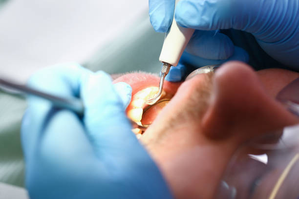 Best Urgent Care for Lost Fillings or Crowns in Crystal City, MO