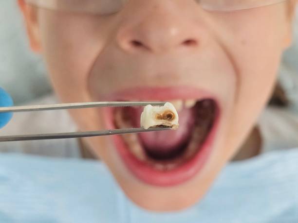 Best Cosmetic Emergency Dentistry in Crystal City, MO